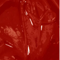 light arterial